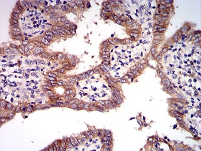 Monoclonal Mouse anti-Human c-Met Antibody (clone 5E9C4, IHC, IF, WB)