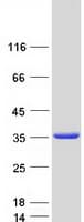 Human TXNDC9 Protein (Recombinant Myc-DDK (Flag))