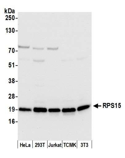 RPS15 / Ribosomal Protein S15 Antibody (aa95-145)