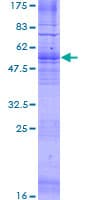 Human GPR12 Protein (Recombinant GST)