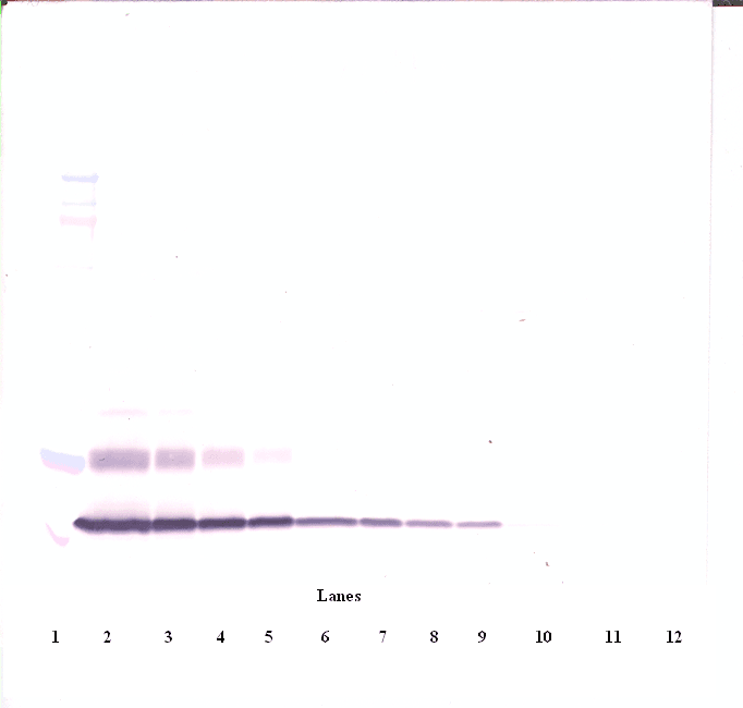Polyclonal Rabbit anti-Human CTGF Antibody (Biotin, WB)