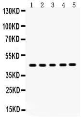 SIRT7 / Sirtuin 7 Antibody (aa8-350)