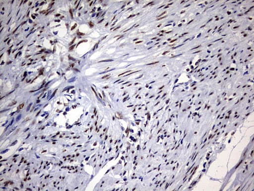 RBFOX1 / A2BP1 Antibody (aa1-210, clone OTI2C12)