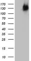 BRCA1 Antibody (aa1151-1473, clone OTI1C4)