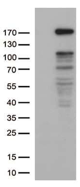 NEDD4 Antibody (aa160-460, clone OTI6E12)