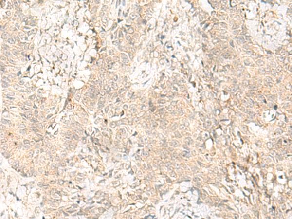 Polyclonal Rabbit anti-Human GPSM1 / AGS3 Antibody (IHC)