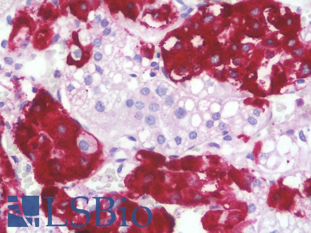 IHC-plus™ Polyclonal Rabbit anti-Human STMN4 / RB3 Antibody (aa140-189, IHC, WB)