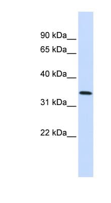 ANXA4 / Annexin IV Antibody (aa108-157)