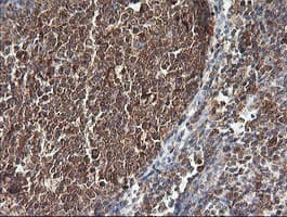 PIK3CG / PI3K Gamma Antibody (clone OTI4B9)