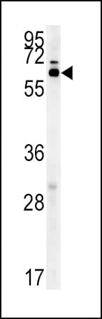 IKZF3 / AIOLOS Antibody (aa76-103)
