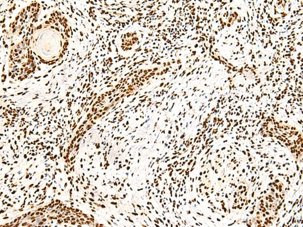 NF90 / ILF3 Antibody