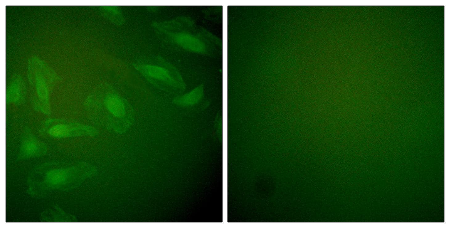 Polyclonal Rabbit anti-Human PARK7 / DJ-1 Antibody (IHC, IF, WB)