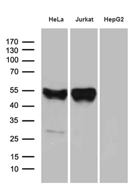 Monoclonal Mouse anti-Human CHIA / Amcase Antibody (clone OTI3G3, WB)