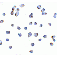 Polyclonal Rabbit anti-Human MAP3K14 Antibody (IF, WB)