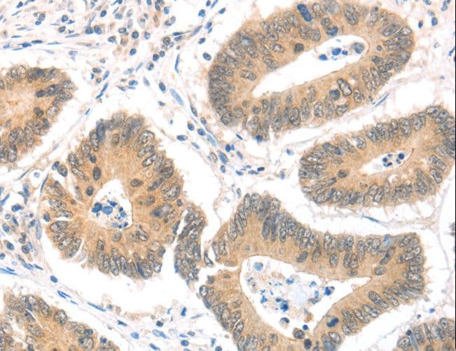 Polyclonal Rabbit anti-Human MAGED1 / NRAGE Antibody (IHC, WB)
