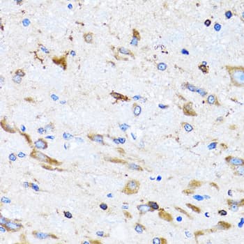 PTRH2 / BIT1 Antibody