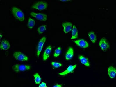 SLC5A2 / SGLT2 Antibody