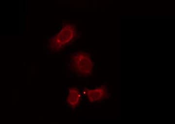 OR7E5P Antibody