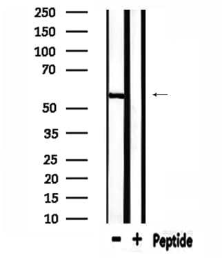 Polyclonal Rabbit anti-Human USP30 Antibody (IF, WB)