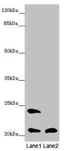 Polyclonal Rabbit anti-Human MSRB3 Antibody (IHC, WB)