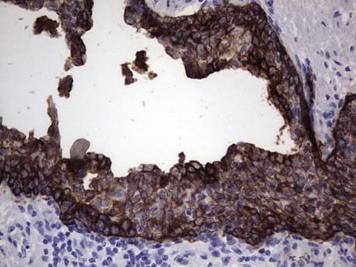 KRT19 / CK19 / Cytokeratin 19 Antibody (aa240-390, clone OTI5G7)