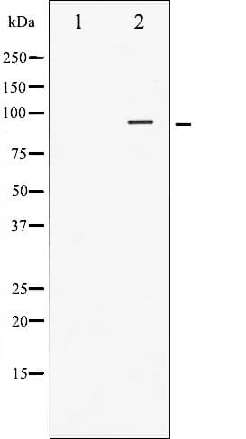 INSR / Insulin Receptor Antibody (phospho-Tyr1355)