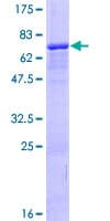 Human ZNF584 Protein (Recombinant GST)