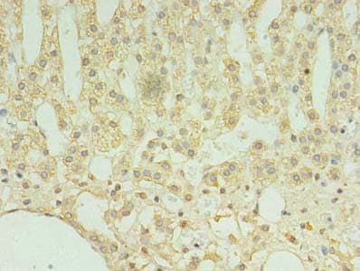 TMEM9 Antibody (aa 111-183)