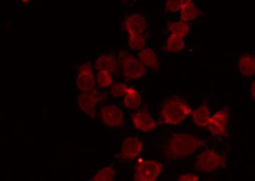 NEP / DDR1 Antibody