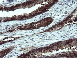 CMPK / CMPK1 Antibody (clone OTI1A1)