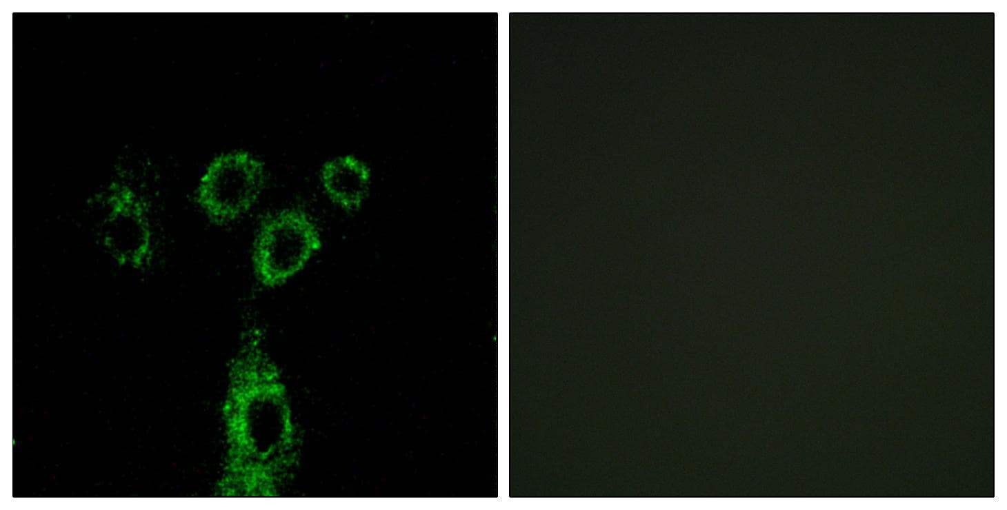 GPRASP1 / GASP-1 Antibody