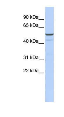 KCNK12 Antibody (aa360-409)