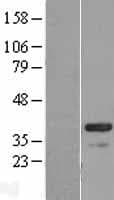 CABP4 Protein (Over-Expression Lysate Myc-DDK (Flag))
