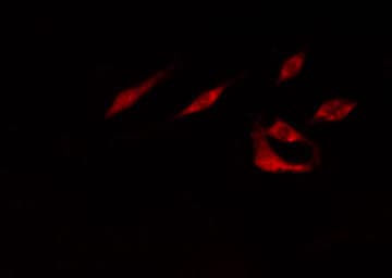 Polyclonal Rabbit anti-Human RRAGA Antibody (IF, WB)