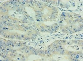 MEP1A / Meprin Alpha Antibody (aa440-700)