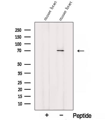SORBS2 / ARGBP2 Antibody