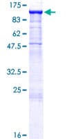 Human CDH16 / Cadherin 16 Protein (Recombinant GST)