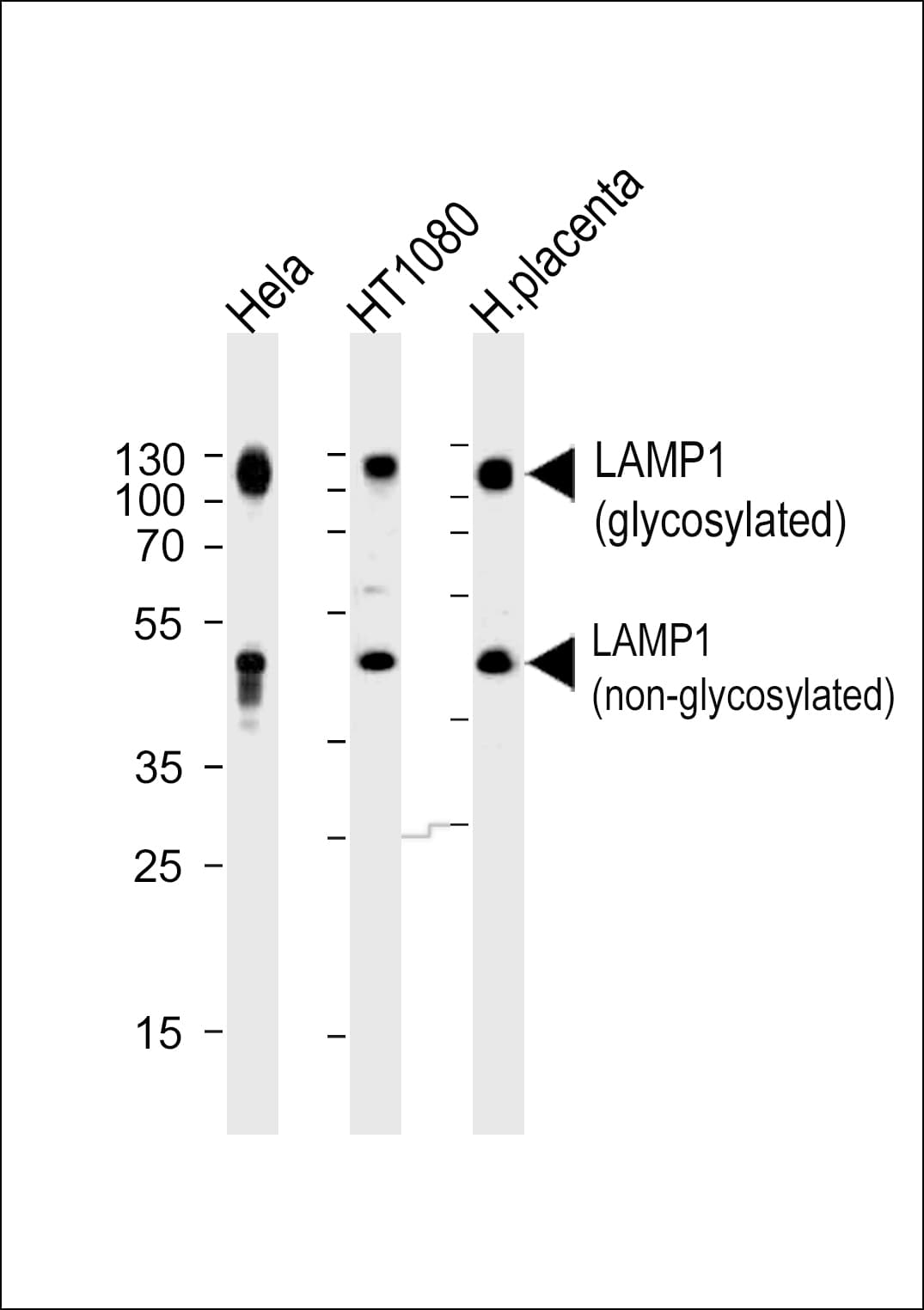 IHC-plus™ Polyclonal Rabbit anti-Human LAMP1 / CD107a Antibody (aa125-154, IHC, WB)