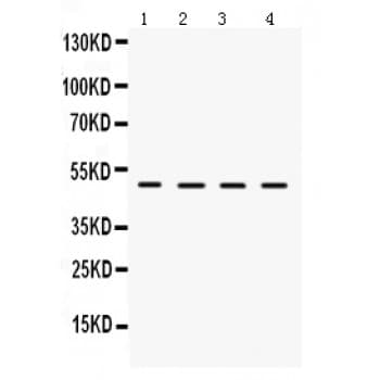 LCAT Antibody (aa389-423)