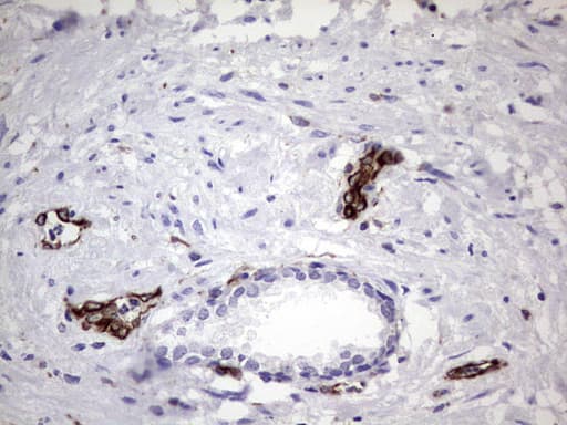 PPP2R5D Antibody (clone OTI3B3)