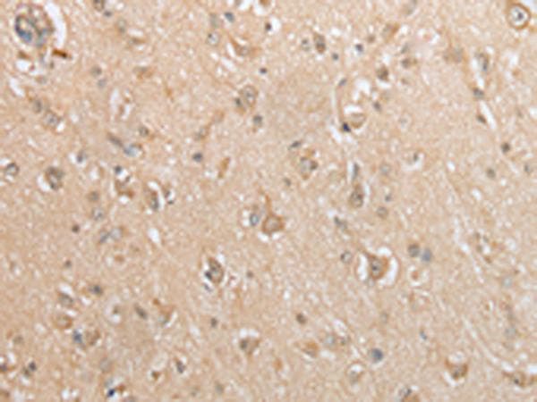 GCLC Antibody