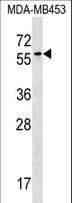 Polyclonal Rabbit anti-Human FSD1 Antibody (aa94-122, WB)