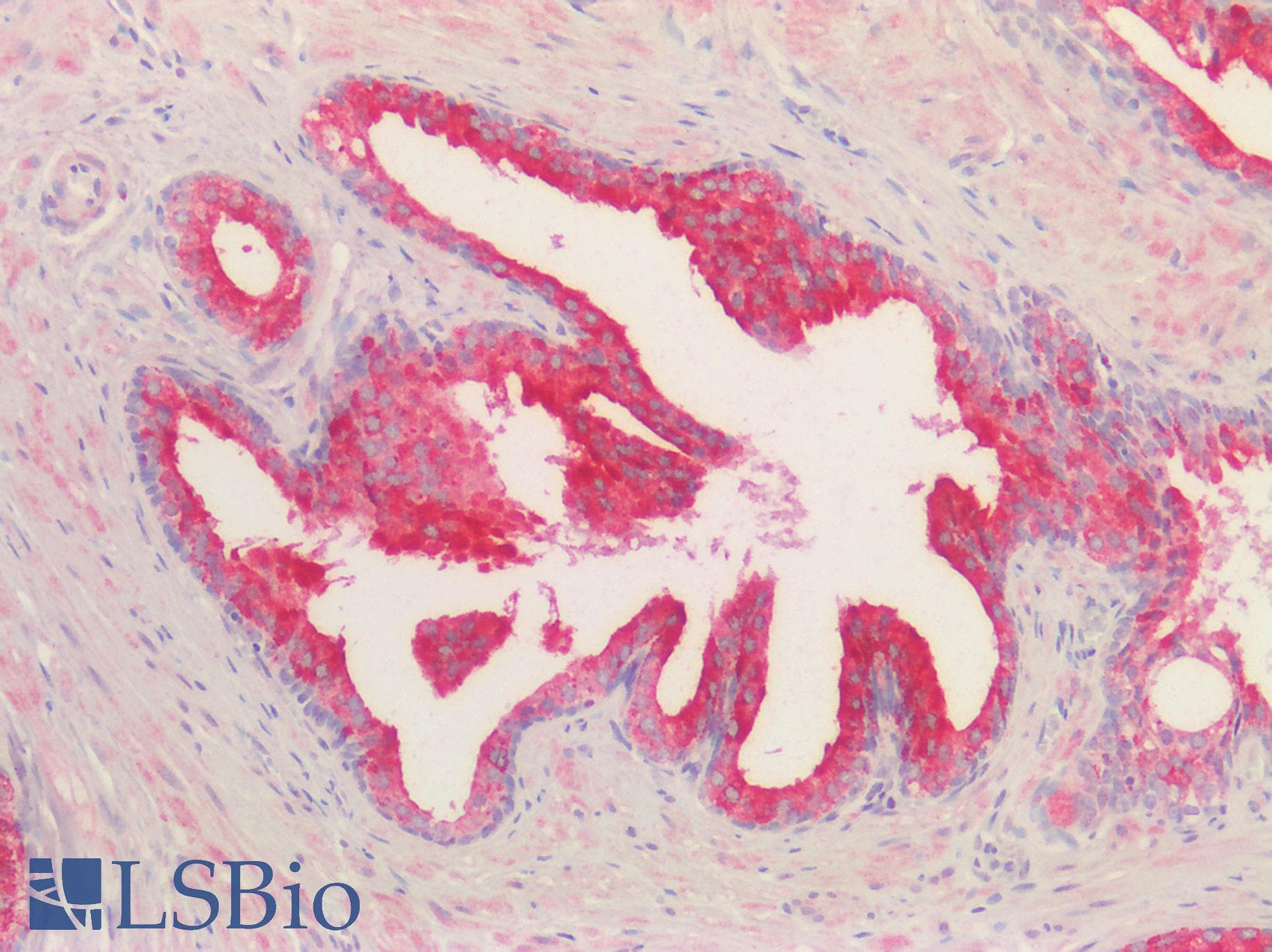 Polyclonal Goat anti-Human KLK2 / Kallikrein 2 Antibody (aa107-120, IHC, WB)