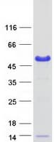 Human BCCIP Protein (Recombinant Myc-DDK (Flag))