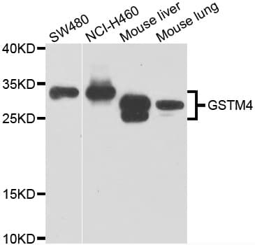 Polyclonal Rabbit anti-Human GSTM4-4 / GSTM4 Antibody (IHC, WB)