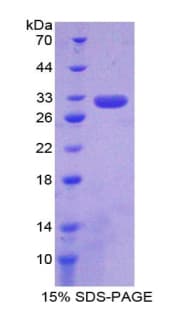 Human Complement C6 Protein (Recombinant His-T7)