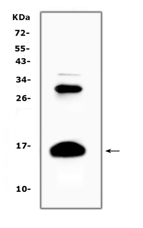 HBD / Hemoglobin Delta Antibody