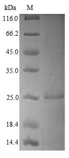 Human NUDT1 / MTH1 Protein (Recombinant 6His, N-terminus)
