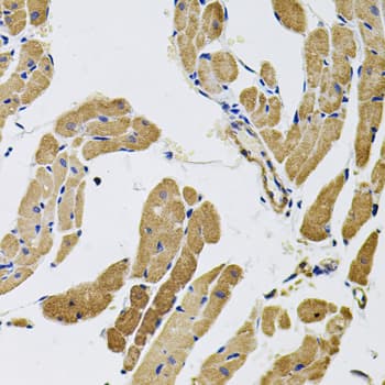 MYO10 / Myosin-X Antibody