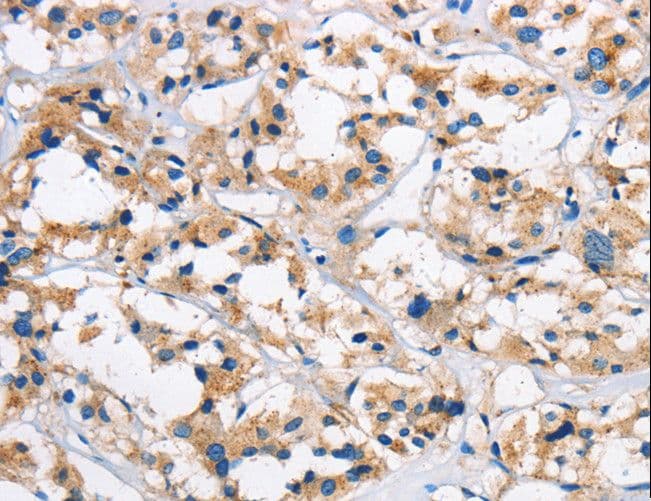 Polyclonal Rabbit anti-Human CTSL / Cathepsin L Antibody (IHC)